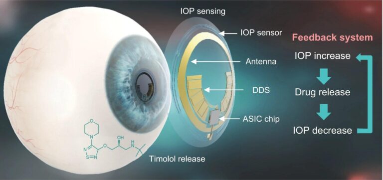 How Smart Contact Lenses Are Revolutionizing Real-Time Health Monitoring
